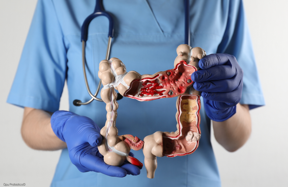 Day 25 - Opu's Daily Digest - Gut Health is a Journey, Not a Destination!